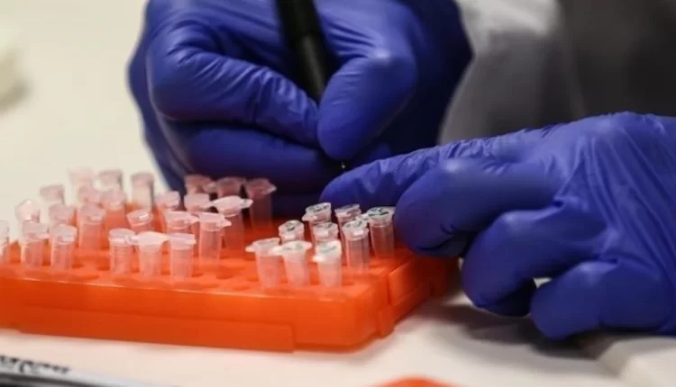 فيروس جدري القردة