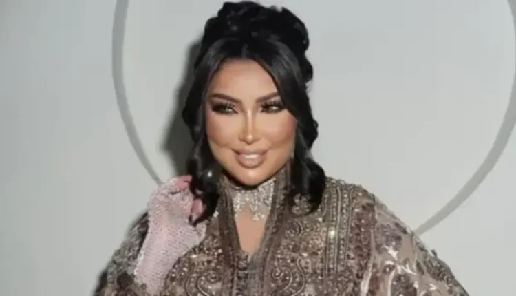 دنيا بطمة تتصدر الترند بعد خروجها من السجن وتغير ملامحها الملفتة